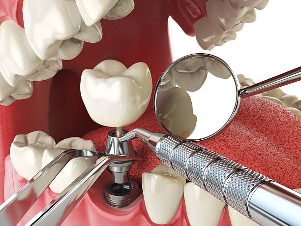 Best Emergency Dentist for Special Needs Patients in Charlotte, TX