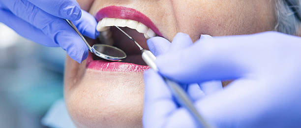 Best Emergency Dental Extractions in Charlotte, TX