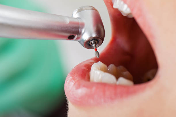 Best Orthodontic Emergency Dentist in Charlotte, TX